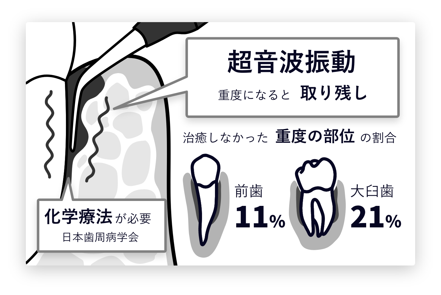 従来の治療の説明イラスト